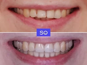 Пример работ стоматология